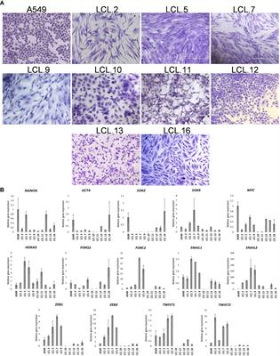 Crosstalk between protein kinases AKT and ERK1/2 in human lung tumor-derived cell models